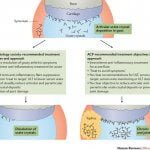 Gout Doctor Dispute Technical Explanation